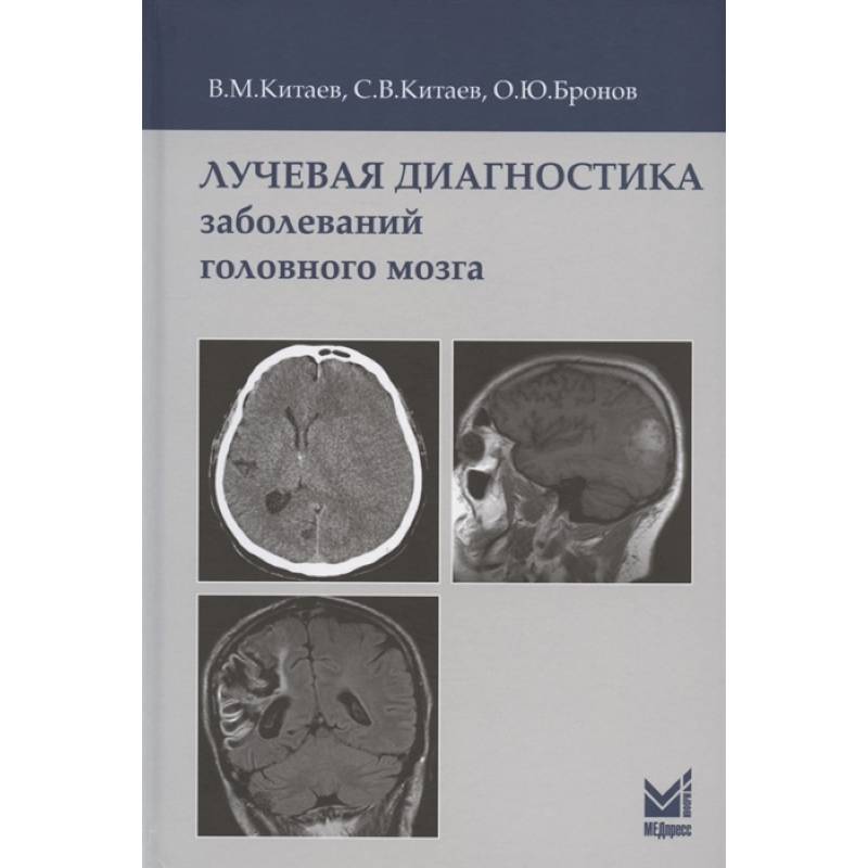 Лучевая диагностика головного мозга презентация