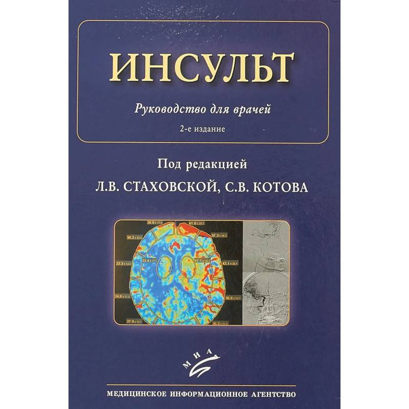 Инсульт : Руководство для врачей