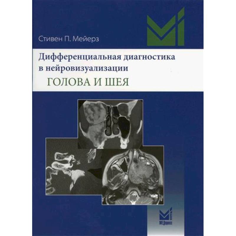 Дифференциальная диагностика в нейровизуализации. Голова и шея