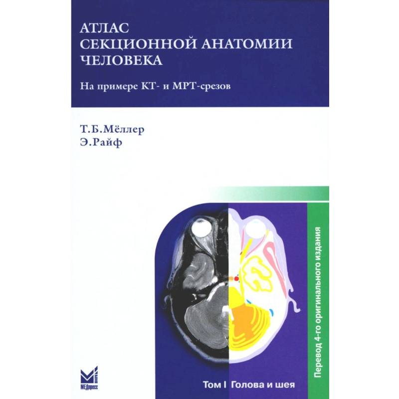 Гарольд эллис атлас анатомии человека в срезах кт и мрт изображениях