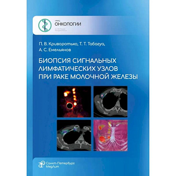 Биопсия сигнальных лимфатических узлов при раке молочной железы