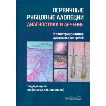Кожные и венерические болезни, книга Первичные рубцовые алопеции. Диагностика и лечение. Иллюстрированное руководство для врачей купить по скидке