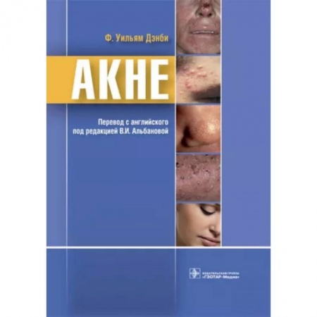 Кожные и венерические болезни, книга Акне купить по скидке