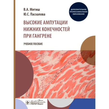 Медицинские энциклопедии и справочники, книга Высокие ампутации нижних конечностей при гангрене купить по скидке