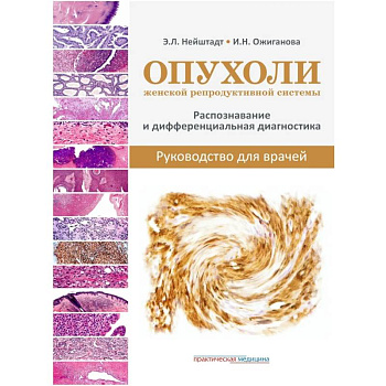 Опухоли женской репродуктивной системы. Распознавание и дифференциальная диагностика. Руководство для врачей
