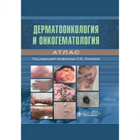 Кожные и венерические болезни, книга Дерматоонкология и онкогематология купить по скидке