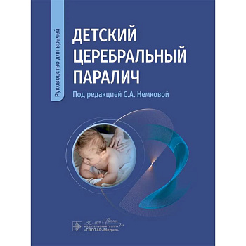Детский церебральный паралич: руководство для врачей