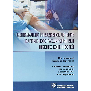 Минимально инвазивное лечение варикозного расширения вен