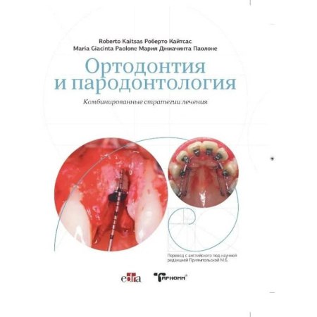 Стоматология, книга Ортодонтия и пародонтология. Комбинированные стратегии лечения купить по скидке