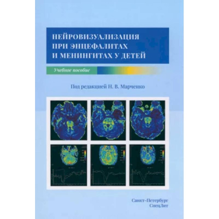 Отдельные виды заболеваний у детей, книга Нейровизуализация при энцефалитах и менингитах у детей купить по скидке