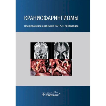 Онкология, книга Краниофарингиомы купить по скидке