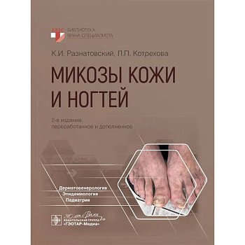 Микозы кожи и ногтей